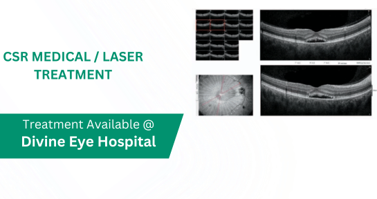 CSR Medical _ Laser Treatment in Panchkula